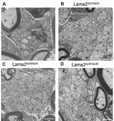 LAMA2 Neuropathies: Human Findings and Pathomechanisms From Mouse Models